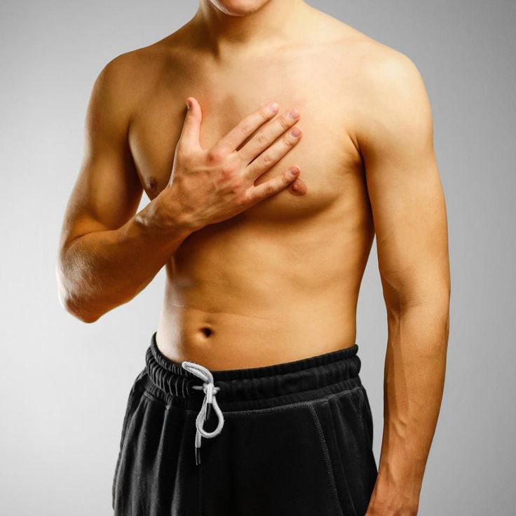 Gynaecomastia