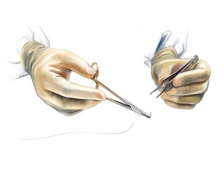 Laceration Repair