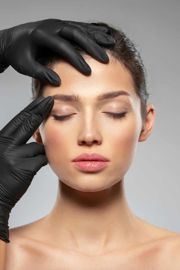 Brow Lift
